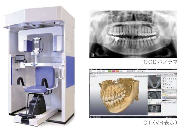 歯科用3DCT